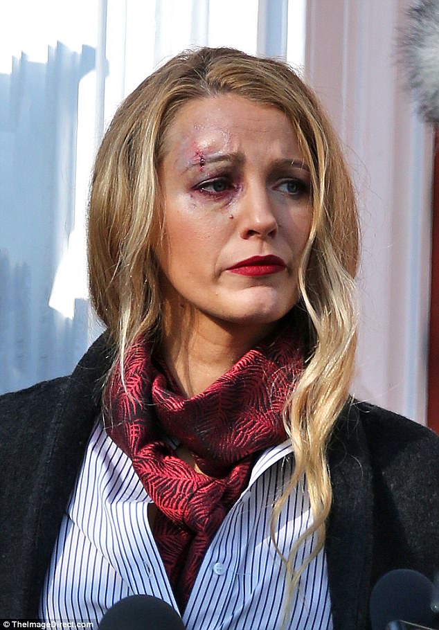 Blake Lively sports a bloodied eye and bruised face on the set of